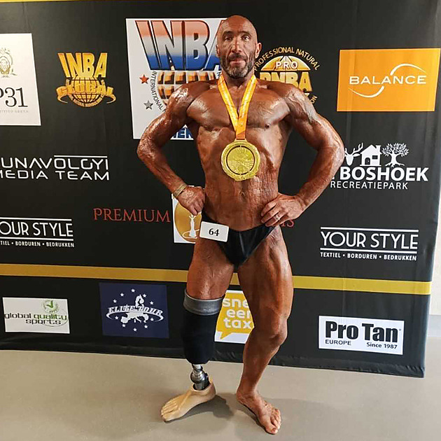 Výboj mu spálil polovinu těla. Kulturista teď chce uspět v soutěži, kde vítězil Arnold